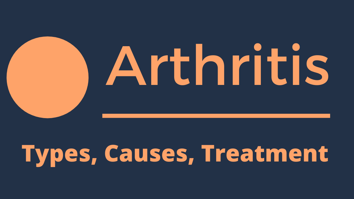 Arthritis treatment and causes